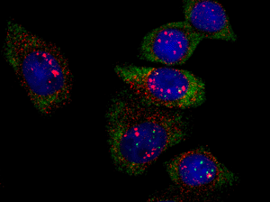 Image: A multiplex image of HER2 mRNA (red), and Beta Actin mRNA (green) with a DAPI nuclear stain (blue). Cells are from the human breast cancer SK-BR-3 cell line, which overexpress HER2 (Photo courtesy of Ryan D.Brady, Biosearch Technologies, Inc.).